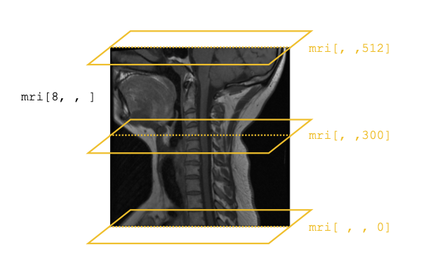 mri cross sections